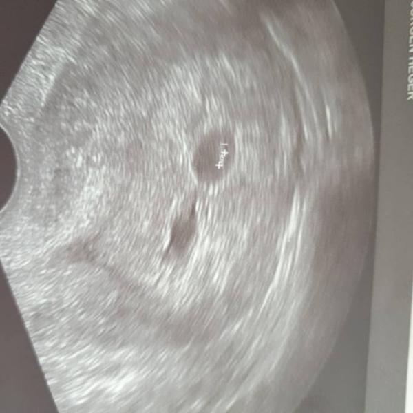 Bild zu Zwillinge??? - Forum für November - Mamis