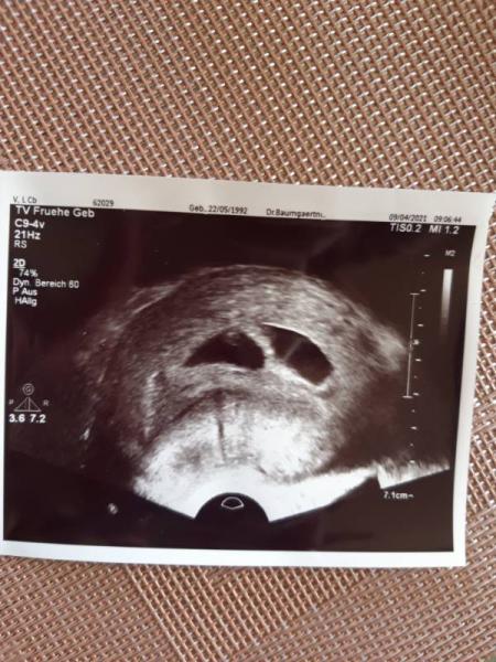 Bild zu Erster FA Besuch - Forum für November - Mamis