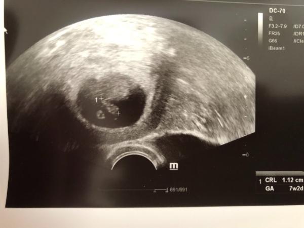 Bild zu Glücklich - Forum für November - Mamis