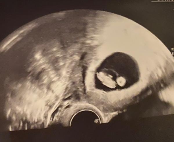 Bild zu Da ist ja wirklich was!!! < 3 - Forum für November - Mamis