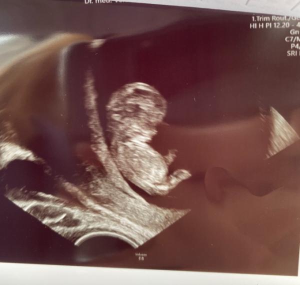 Bild zu Boy or Girl? Kann man schon was erkennen? - Forum für November - Mamis