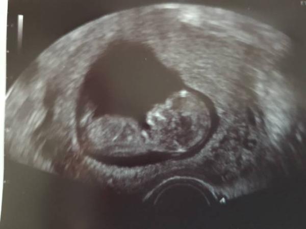 Bild zu Familie informiert und gute Nachrichten - Forum für November - Mamis