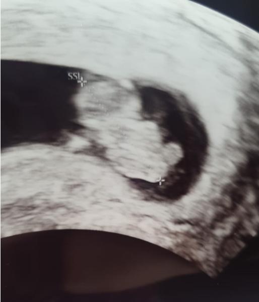 Bild zu Darf ich vorstellen =) - Forum für November - Mamis