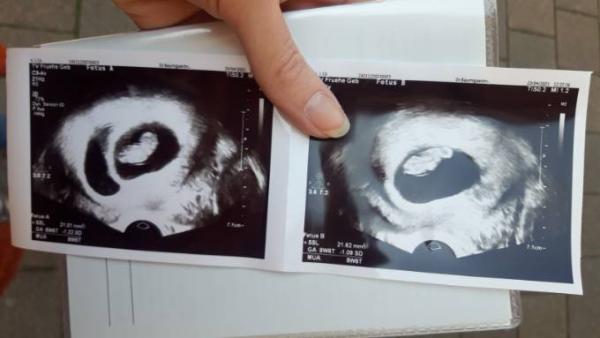Bild zu FA Termin - Forum für November - Mamis