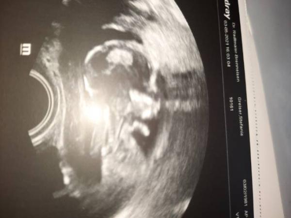 Bild zu Ausser planmäßig beim FA - Forum für November - Mamis