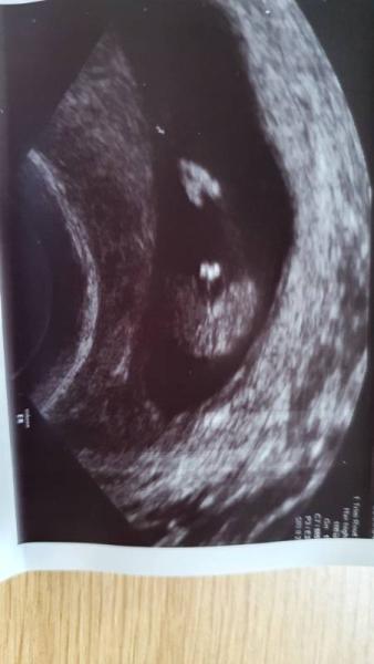 Bild zu Geschlecht 13.SSW? - Forum für November - Mamis