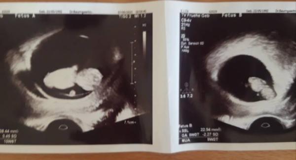 Bild zu FA Termin - Forum für November - Mamis