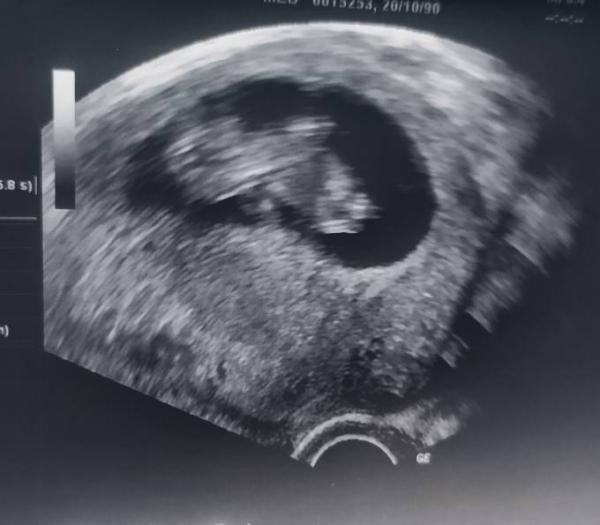 Bild zu Liebe November Mamis - Forum für November - Mamis