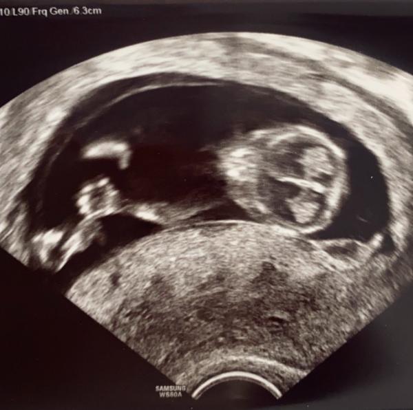 Bild zu Heute ebenfalls zurück vom Doc ❤️ - Forum für November - Mamis