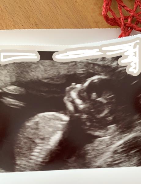 Bild zu Skull Theorie - Forum für November - Mamis