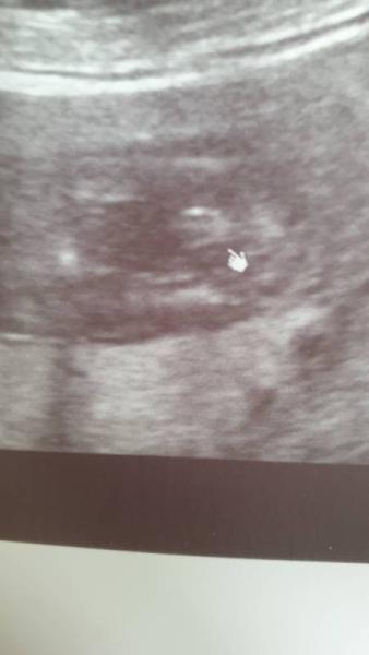 Bild zu Geschlecht - Forum für November - Mamis