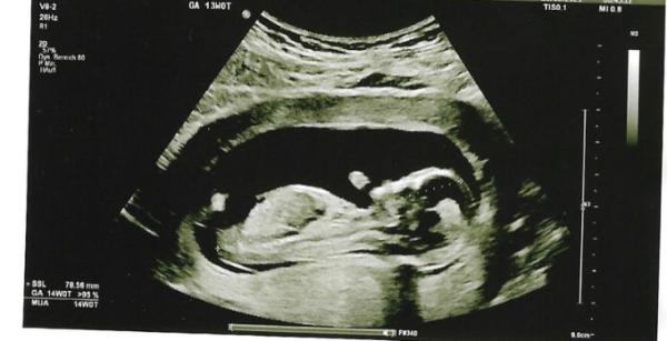 Bild zu Zurück vom Ultraschall - Forum für November - Mamis