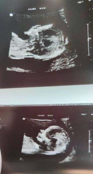 Bild zu Auch zurück vom FA - Forum für November - Mamis
