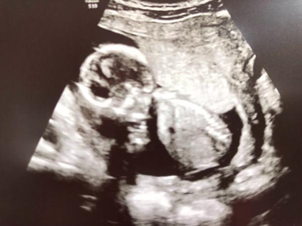 Bild zu Zurück vom Frauenarzt - Forum für November - Mamis