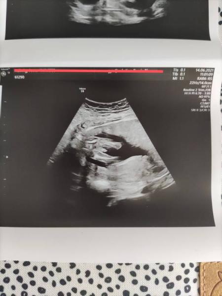 Bild zu FA Termin und Outing - Forum für November - Mamis