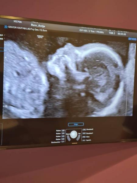 Bild zu Großes Screening heute - Forum für November - Mamis