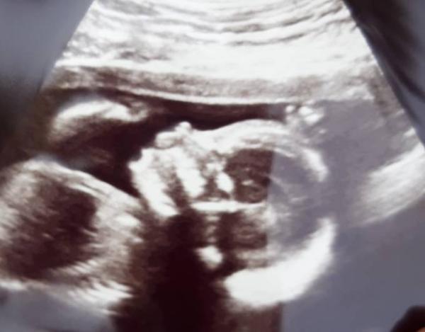 Bild zu 2. Großer Ultraschall - Forum für November - Mamis