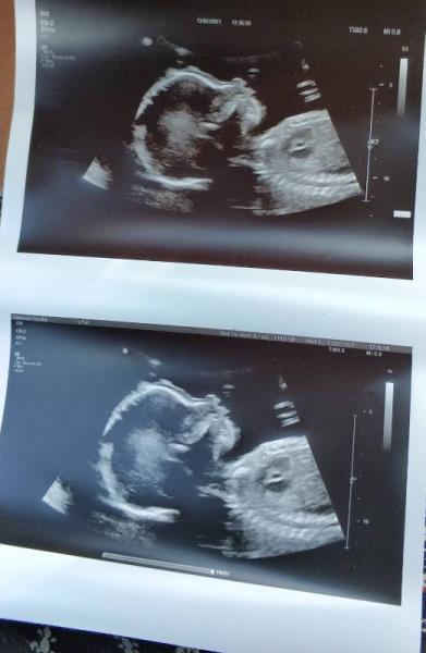 Bild zu Auch zurück vom FA - Forum für November - Mamis