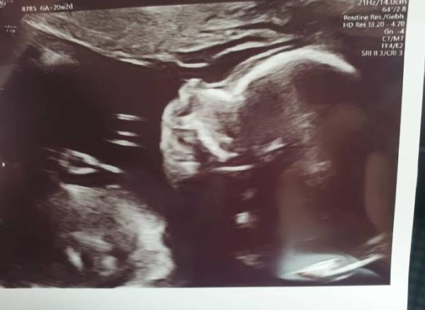 Bild zu 2. Ultraschall - Forum für November - Mamis
