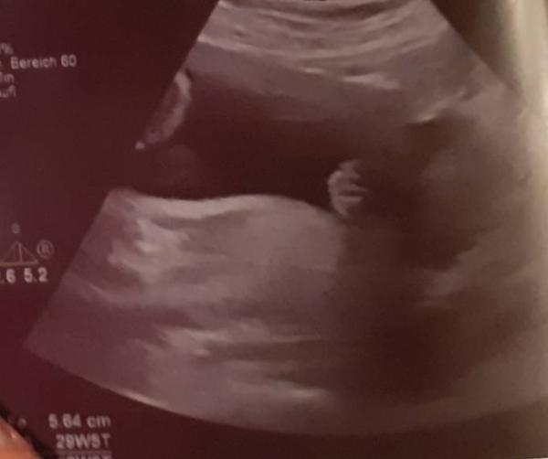 Bild zu Mädchen oder Junge - Forum für November - Mamis