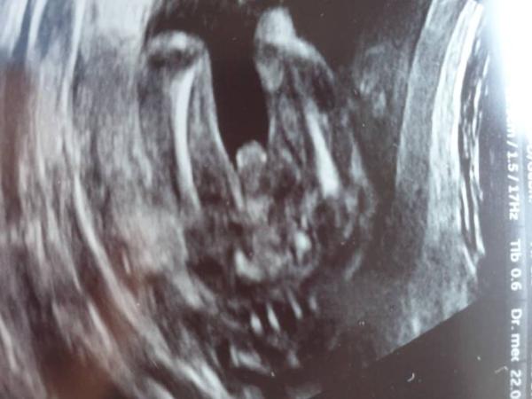 Bild zu Geschlecht erkennen in 20 ssw - Forum für November - Mamis