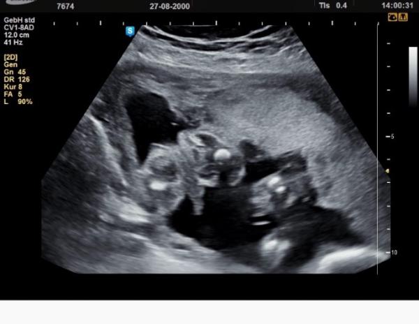 Bild zu Geschlecht - Forum für November - Mamis