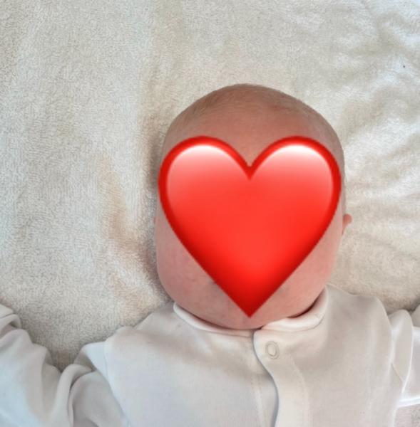 Bild zu Kopfverformung - Forum für November - Mamis