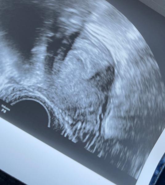 Bild zu Aufregend 🥰 - Forum für November - Mamis