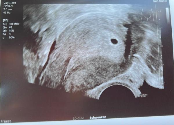 Bild zu Das Gedankenkarussell - Forum für November - Mamis