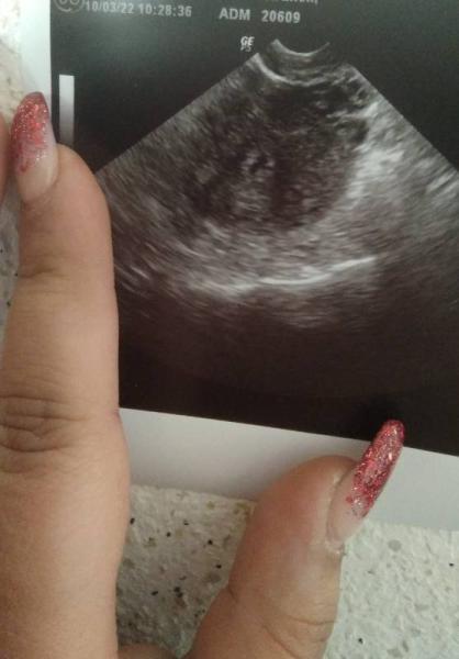 Bild zu 6ssw verunsichert - Forum für November - Mamis
