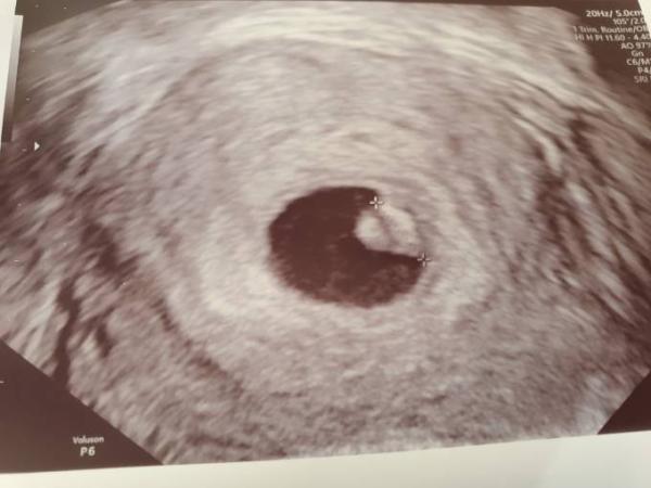 Bild zu Herzchen schlägt 🥰 - Forum für November - Mamis