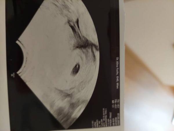 Bild zu Alles normal? - Forum für November - Mamis