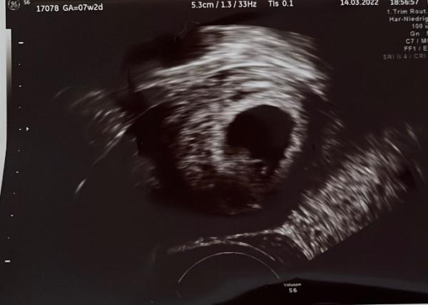 Bild zu Eckenhocker ? - Forum für November - Mamis
