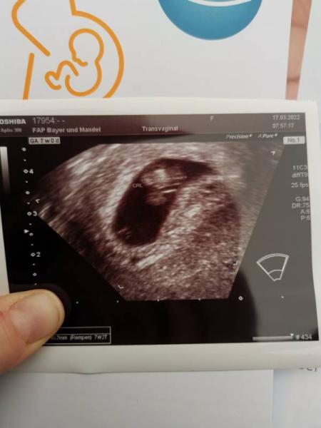 Bild zu Erster FA Besuch - Forum für November - Mamis