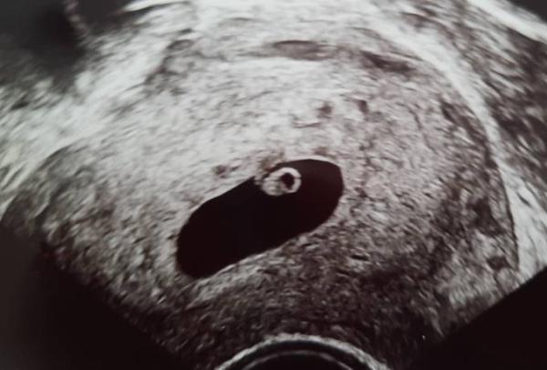 Bild zu 6+3 - Forum für November - Mamis