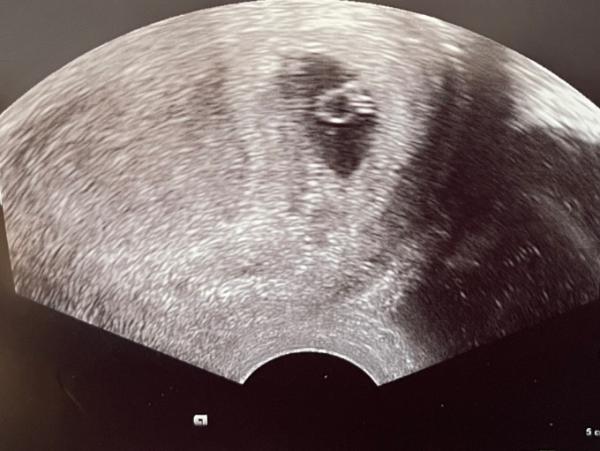 Bild zu Herzchen schlägt 😍 - Forum für November - Mamis