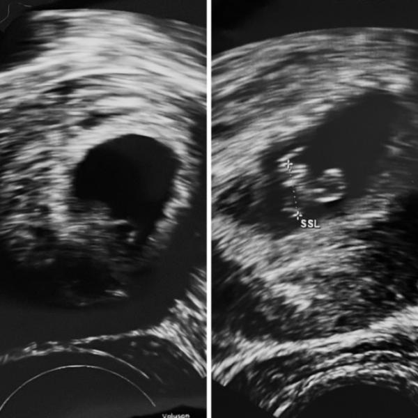 Bild zu Ultraschall und super Glücklich - Forum für November - Mamis