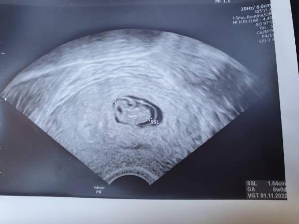 Bild zu Offiziell aus der Kiwuklinik entlassen 🥰 - Forum für November - Mamis