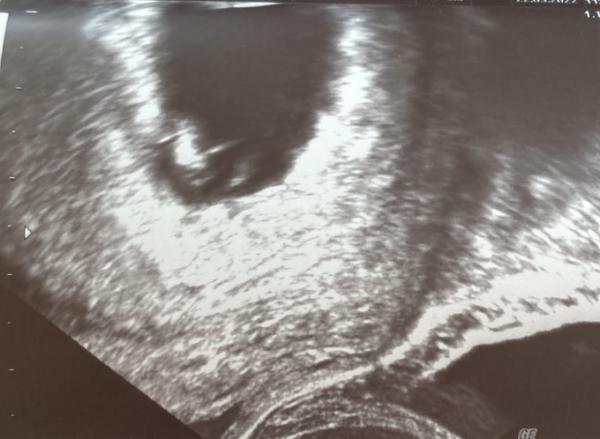 Bild zu 1. Termin - Forum für November - Mamis