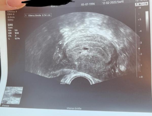 Bild zu Erster Termin beim FA - Forum für November - Mamis