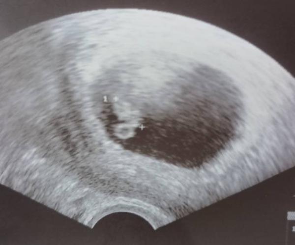 Bild zu Update - Forum für November - Mamis