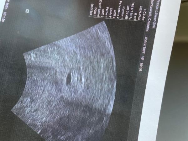 Bild zu Arzt hat mir total Angst eingejagt ! Hilfe :( - Forum für November - Mamis