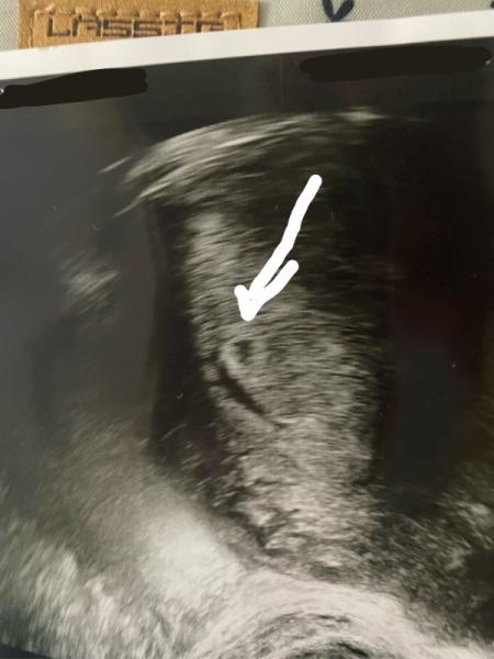 Bild zu Mit 43 schwanger 🥰Novemberbaby - Forum für November - Mamis