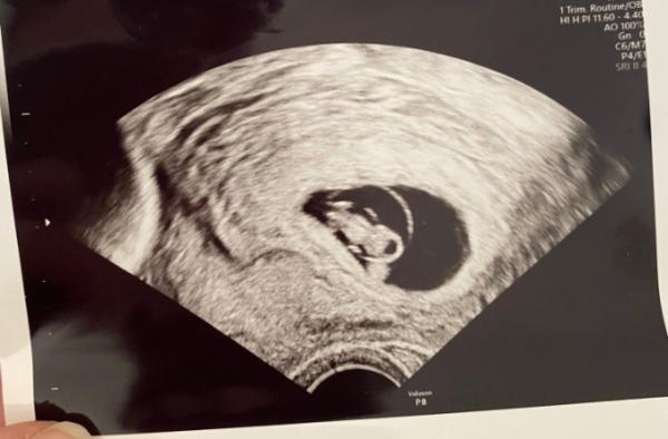 Bild zu 1. Termin - Forum für November - Mamis