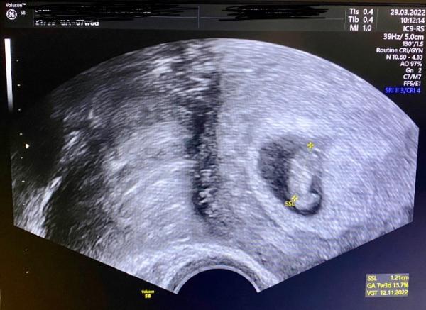 Bild zu Zweite Untersuchung 🥰 - Forum für November - Mamis