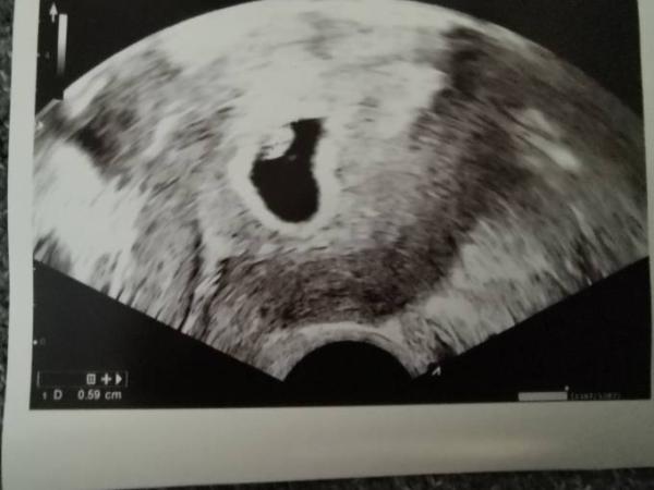 Bild zu 1. FA-Termin - Forum für November - Mamis