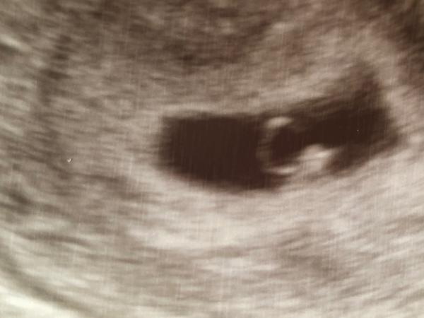 Bild zu Zurück vom 1. FA-Termin - Forum für November - Mamis
