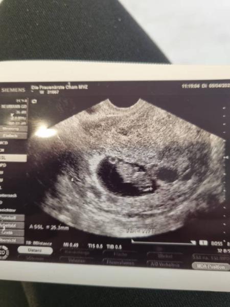 Bild zu Gestern wieder FA termin gehabt < 3 - Forum für November - Mamis