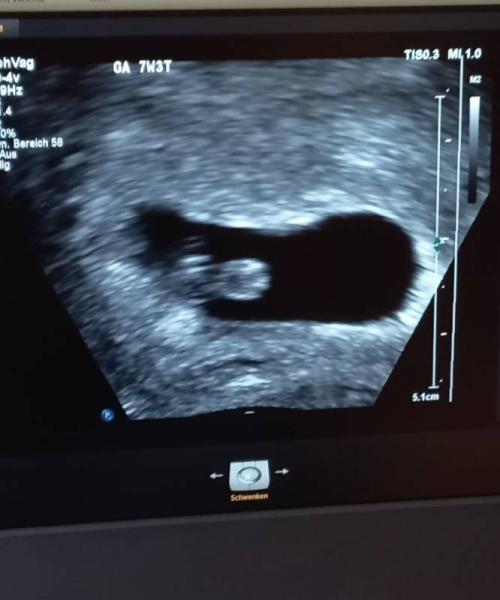 Bild zu Endlich der erste Ultraschall  - Forum für November - Mamis