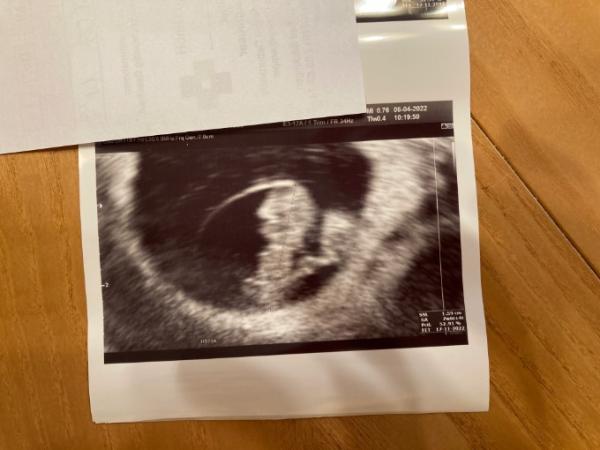 Bild zu Wir haben einen Herzschlag - Forum für November - Mamis
